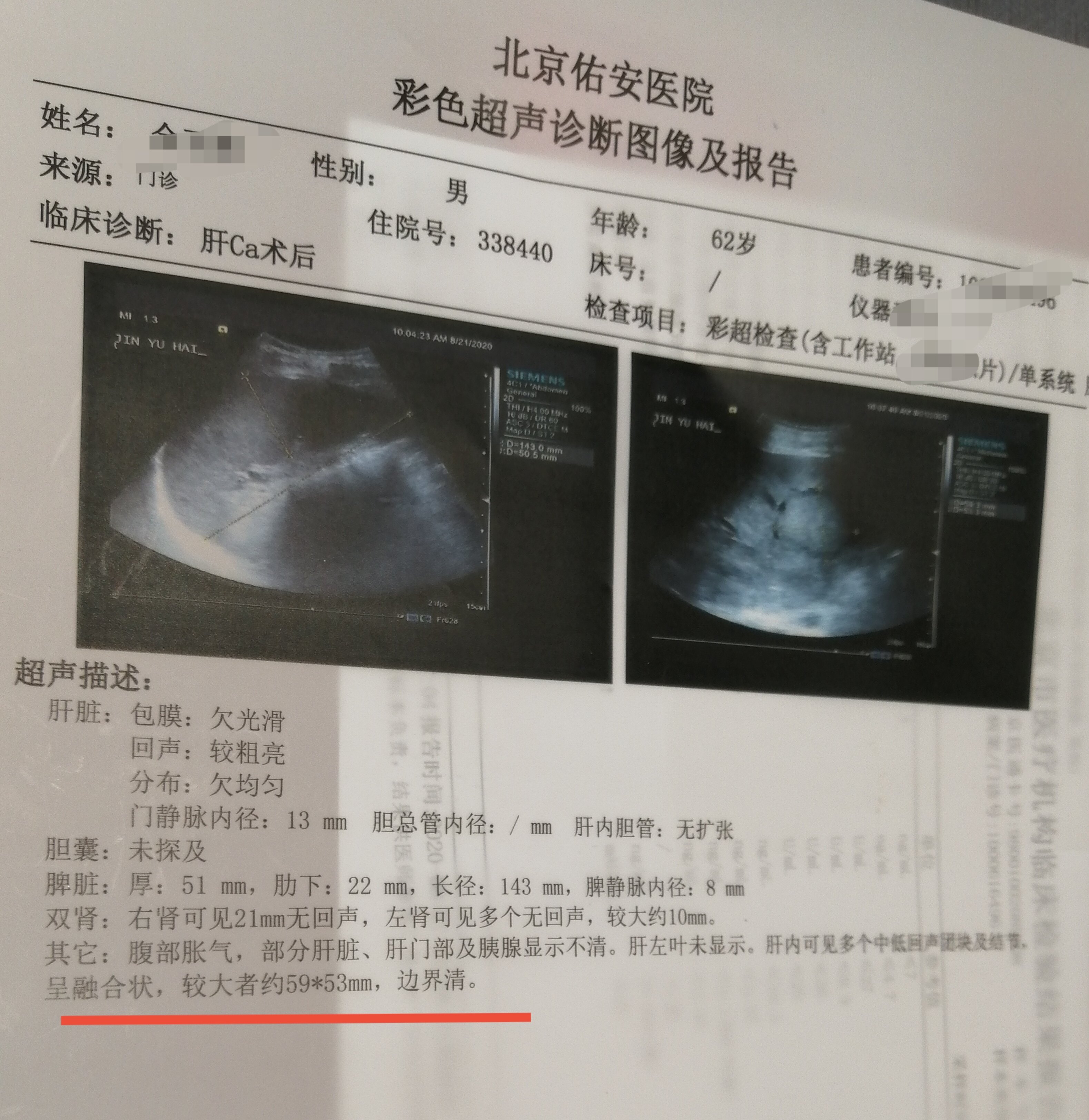 重慶男子狂奔9小時逃出緬北