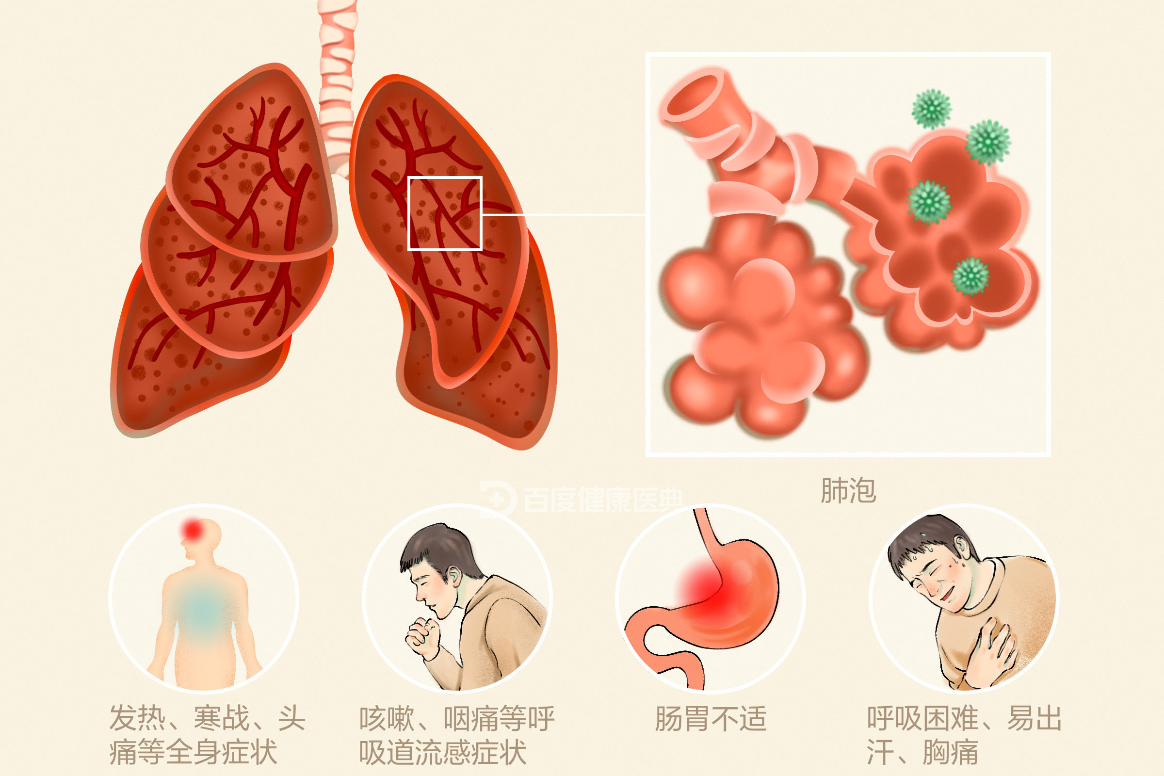 入冬使用加濕器會引發(fā)肺炎？