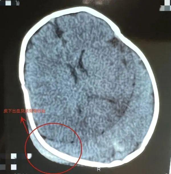 事發(fā)上海，家長抱娃坐副駕駛，遇車禍幼童瞬間被甩出不幸身亡